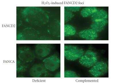 Knockdown Validated: FANCD2 Antibody - BSA Free [NB100-182]