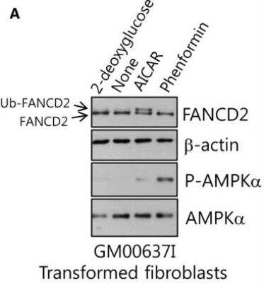 Western Blot: FANCD2 AntibodyBSA Free [NB100-182]