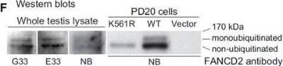 Western Blot: FANCD2 AntibodyBSA Free [NB100-182]
