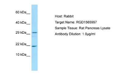 Western Blot: FANCD2OS Antibody [NBP1-98261]