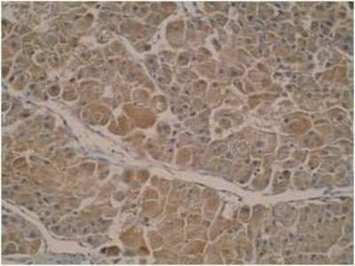 Immunohistochemistry: FANCE Antibody (L5-P1E6*G5) - BSA Free [NBP2-50400]