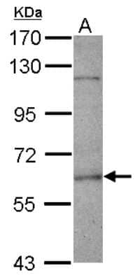 Western Blot: FANCE Antibody [NBP2-16428]