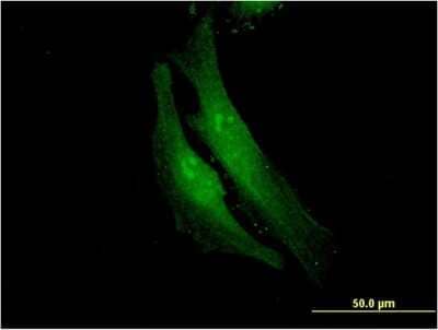 Immunocytochemistry/ Immunofluorescence: FANCF Antibody (3C4) [H00002188-M03]