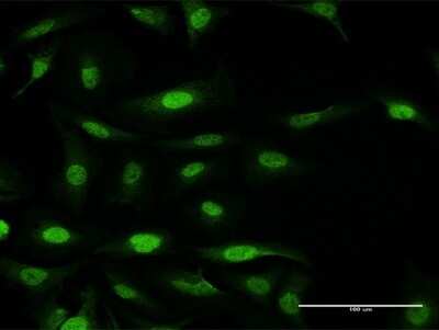 Immunocytochemistry/ Immunofluorescence: FANCF Antibody [H00002188-B01P]