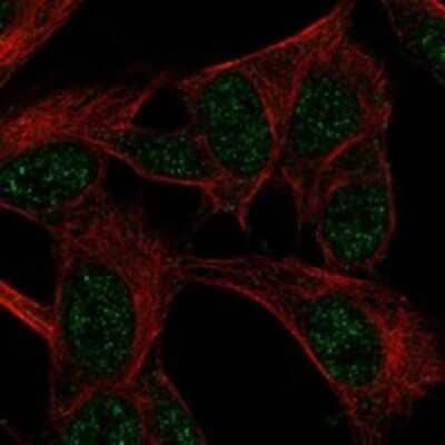 Immunocytochemistry/ Immunofluorescence: FANCF Antibody [NBP3-17845]