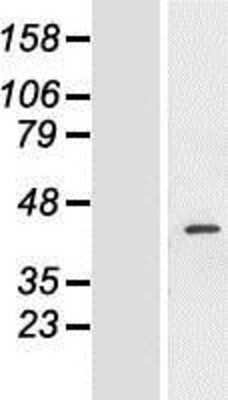 Western Blot: FANCF Overexpression Lysate [NBL1-10588]