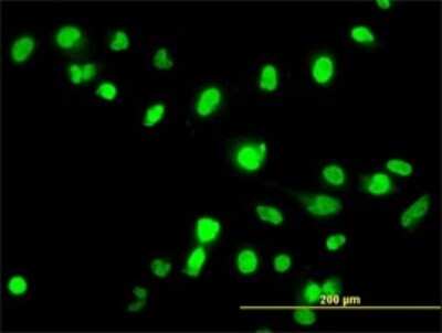 Immunocytochemistry/ Immunofluorescence: FANCG Antibody (2C8) [H00002189-M01]