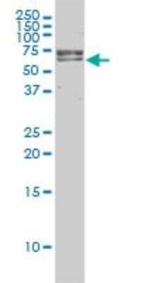 Western Blot: FANCG Antibody (2C8) [H00002189-M01]