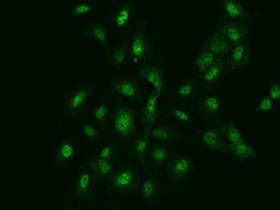 Immunocytochemistry/ Immunofluorescence: FANCG Antibody [NBP2-98109]