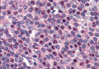 Immunohistochemistry-Paraffin: FANCG Antibody [NBP1-06035]