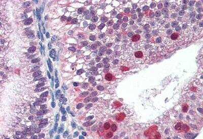 Immunohistochemistry-Paraffin: FANCG Antibody [NBP1-06035]