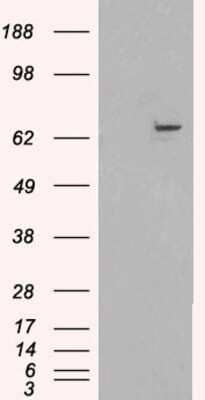 Western Blot: FANCG Antibody [NBP1-06035]