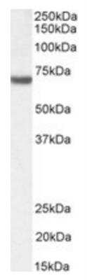 Western Blot: FANCG Antibody [NBP1-06035]