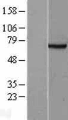 Western Blot: FANCG Overexpression Lysate [NBL1-10589]