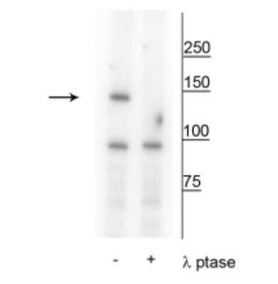 Western Blot: FANCI [p Ser556] Antibody [NBP2-60780]