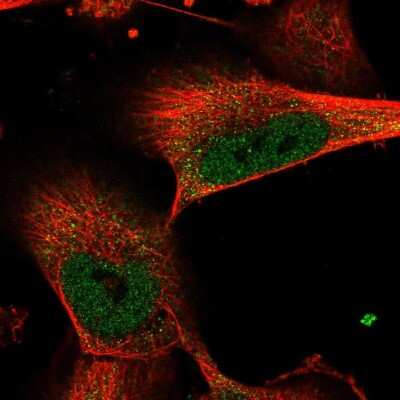 Immunocytochemistry/ Immunofluorescence: FANCI Antibody [NBP2-55040]