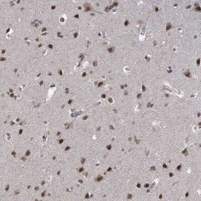 Immunohistochemistry-Paraffin: FANCI Antibody [NBP1-84608]