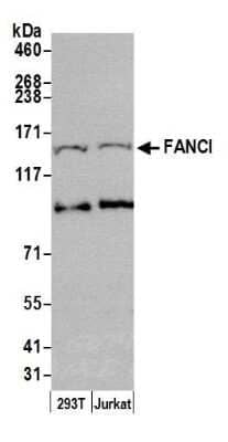 Western Blot: FANCI Antibody [NB100-60447]