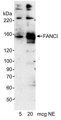 Western Blot: FANCI Antibody [NB300-243]