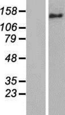 Western Blot: BRIP1/FANCJ Overexpression Lysate [NBP2-06081]