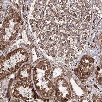 Immunohistochemistry-Paraffin: FANCL Antibody [NBP1-84759]