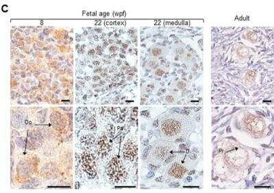 Immunohistochemistry: FANCM Antibody (CV5.1) - BSA Free [NBP2-50418]