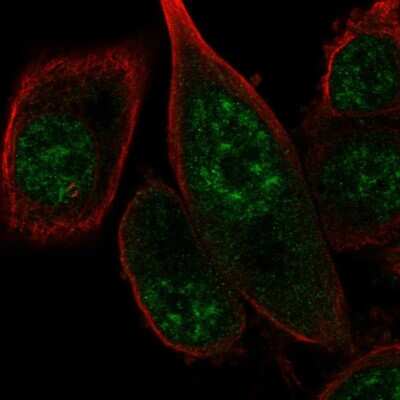 Immunocytochemistry/ Immunofluorescence: FANCM Antibody [NBP2-55444]