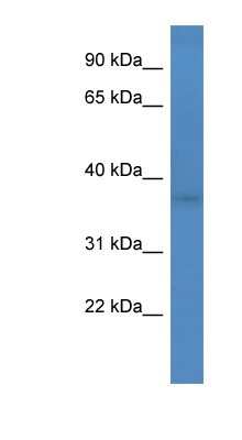 Western Blot: FANK1 Antibody [NBP1-69009]