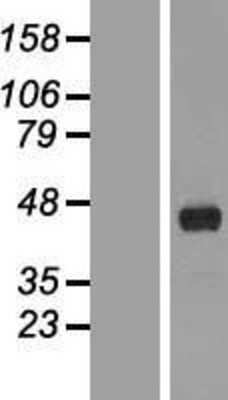 Western Blot: FANK1 Overexpression Lysate [NBL1-10591]