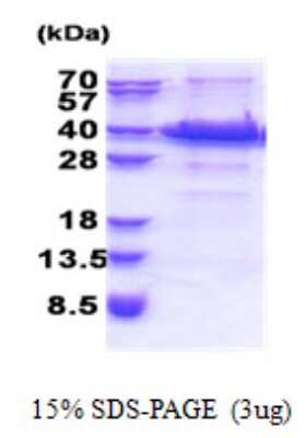 SDS-PAGE: Recombinant Human FANK1 His Protein [NBP2-23052]