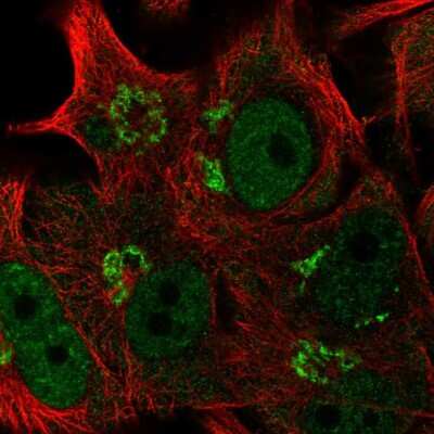 Immunocytochemistry/ Immunofluorescence: FAPP2 Antibody [NBP2-55932]