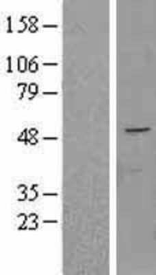 Western Blot: FAPP2 Overexpression Lysate [NBL1-14505]