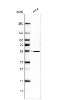 Western Blot: FAR1 Antibody [NBP1-89847]