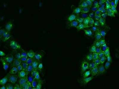 Immunocytochemistry/ Immunofluorescence: FAR2 Antibody [NBP2-97541]