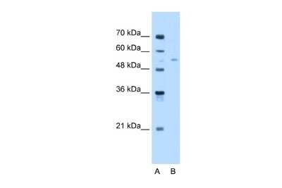 Western Blot: FAR2 Antibody [NBP2-82733]