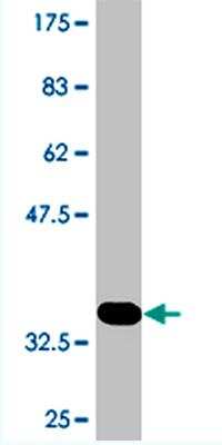 Western Blot: FARP1 Antibody (2D4) [H00010160-M01]