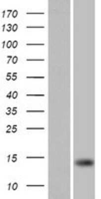 Western Blot: FARP1 Overexpression Lysate [NBP2-08953]