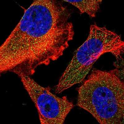 Immunocytochemistry/ Immunofluorescence: FARP2 Antibody [NBP2-57178]