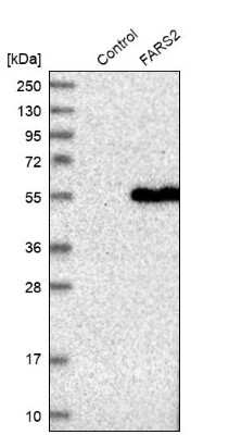 Western Blot: FARS2 Antibody [NBP1-85188]