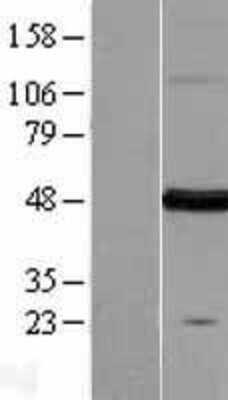 Western Blot: FARS2 Overexpression Lysate [NBL1-10595]