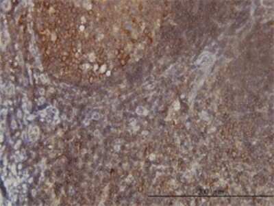 Immunohistochemistry-Paraffin: FARSB Antibody (2F11) [H00010056-M01]