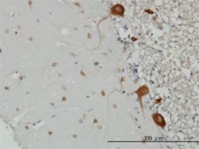Immunohistochemistry-Paraffin: FARSB Antibody (2F11) [H00010056-M01]