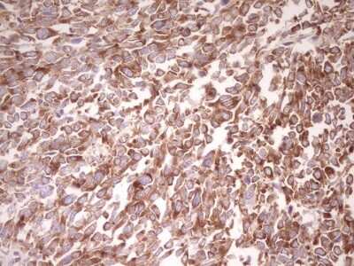 Immunohistochemistry: FARSB Antibody (OTI4B3) [NBP2-45577]