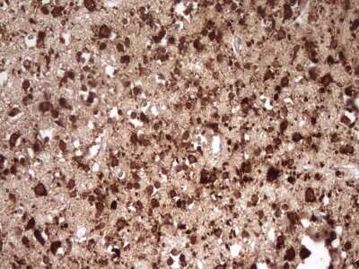 Immunohistochemistry: FARSB Antibody (OTI4B3) [NBP2-45577]