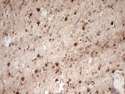 Immunohistochemistry: FARSB Antibody (OTI4B3) [NBP2-45577]