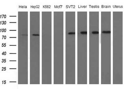 Western Blot: FARSB Antibody (OTI4B3) [NBP2-45577]