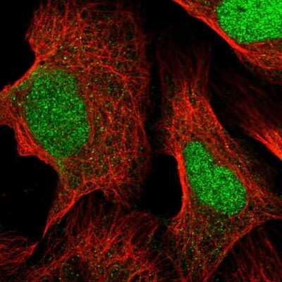 Immunocytochemistry/ Immunofluorescence: FARSB Antibody [NBP1-83923]