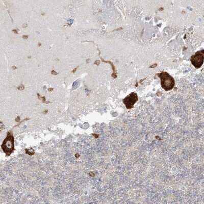 Immunohistochemistry: FARSB Antibody [NBP2-38314]