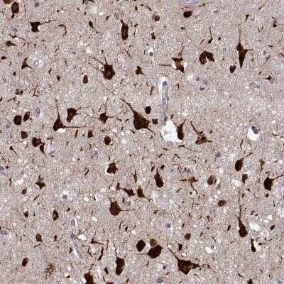 Immunohistochemistry: FARSB Antibody [NBP2-38917]