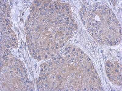 Immunohistochemistry-Paraffin: FARSB Antibody [NBP2-16430]